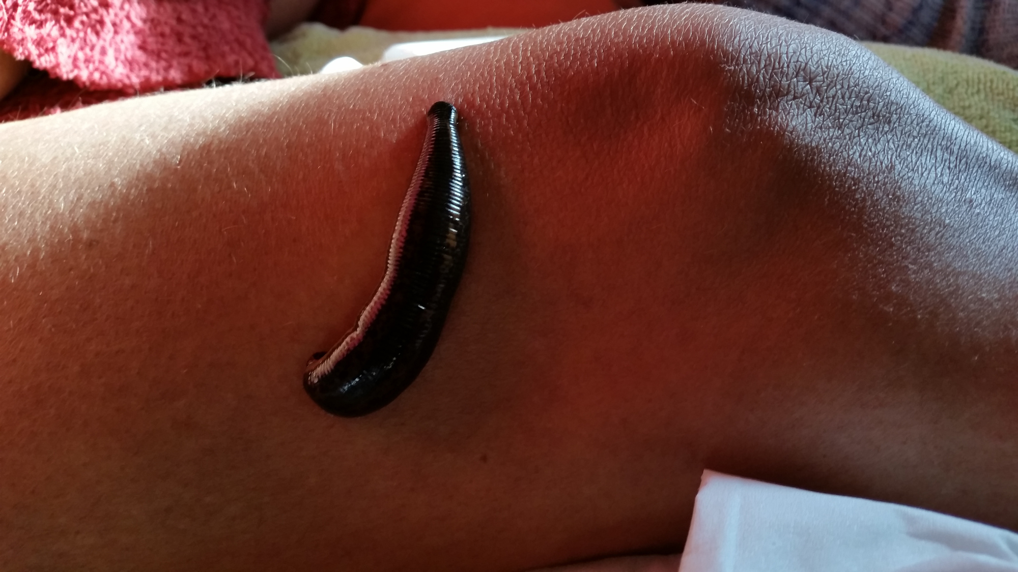 Atelier Turmalin, Markus Etzensberger, Blutegel, Hirudotherapie